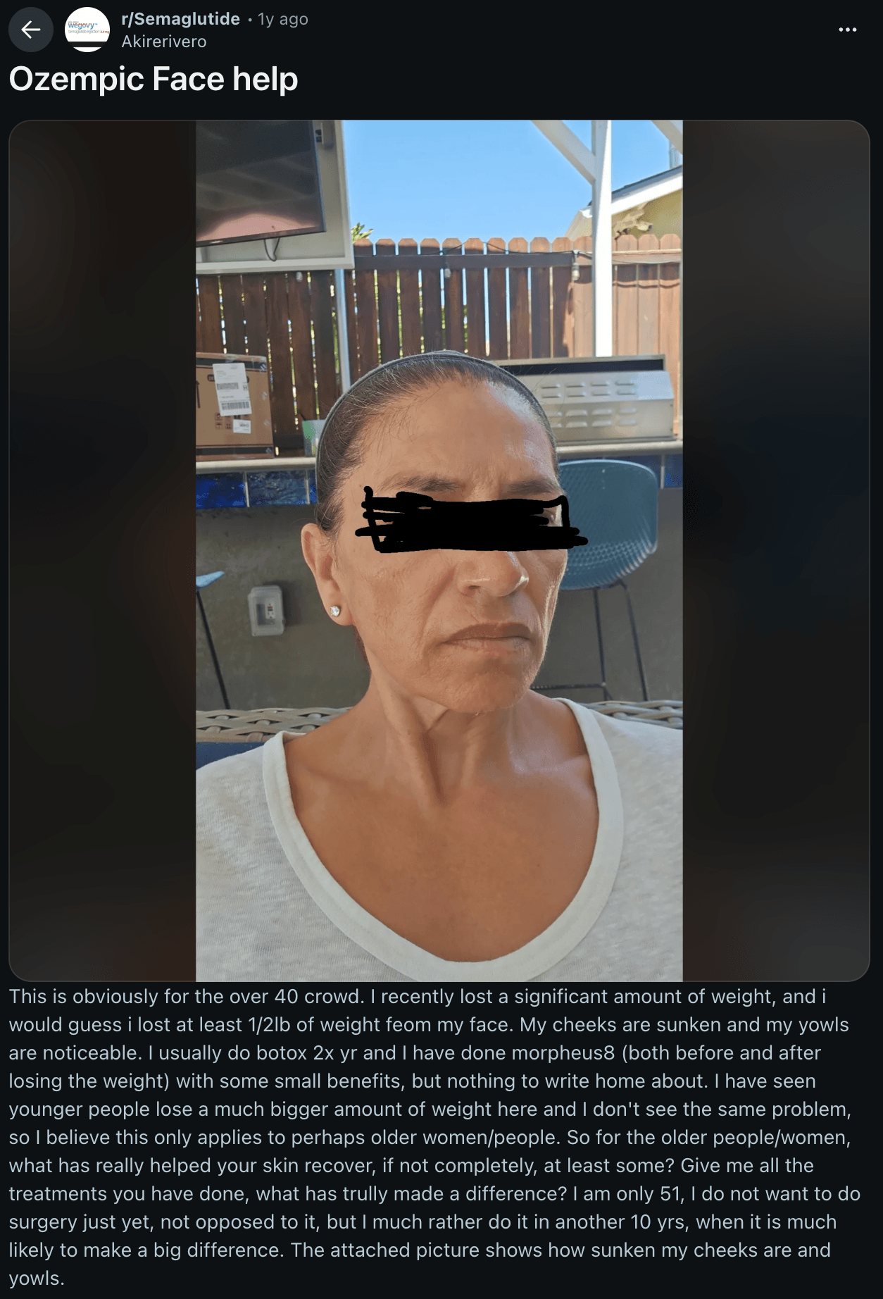 A Redditor posting about her Ozempic face